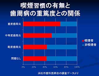 タバコと歯周炎